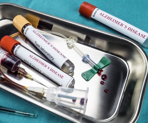 The U.S. Food and Drug Administration said on Friday it has cleared Fujirebio Diagnostics' blood tes...