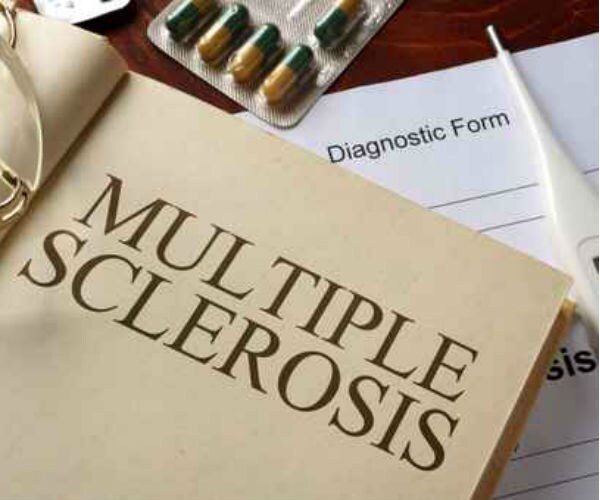 multiple sclerosis 