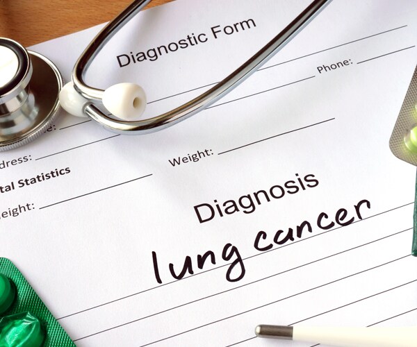 lung cancer