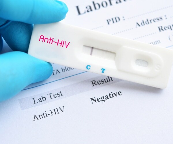negative HIV test