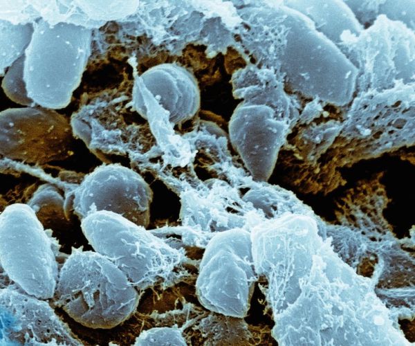 Village in China Locked Down After Resident Dies from Bubonic Plague