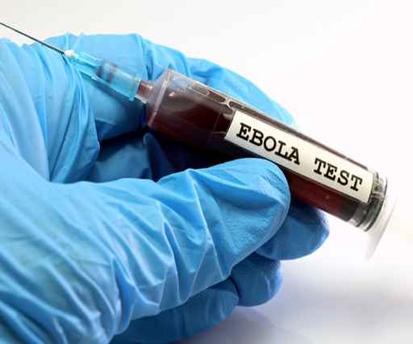 Ebola Lingers in Males for Up to 9 Months: Study