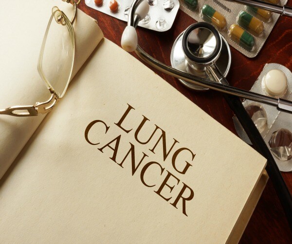 Surgery Extends Lifespan in Lung Cancer 