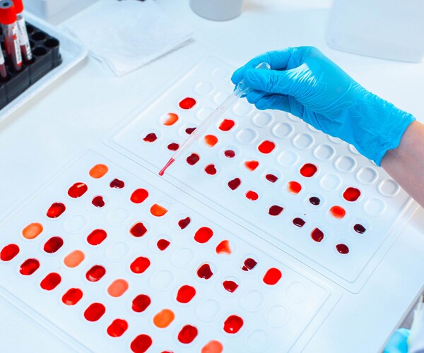 a lab technician determining blood type
