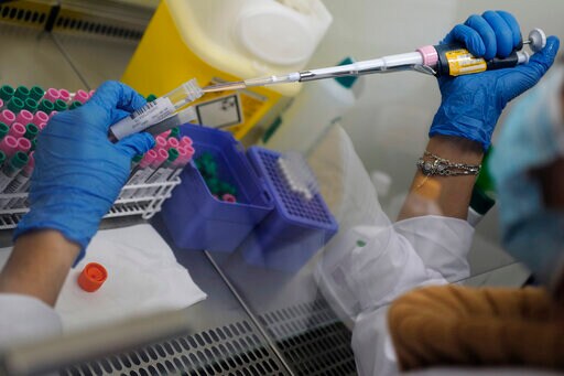 French Virus Testing Labs under Strain amid Resurgent Demand