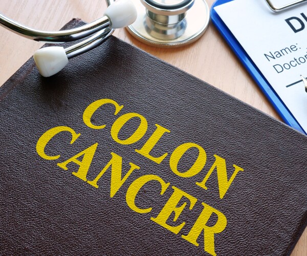 a book titled colon cancer
