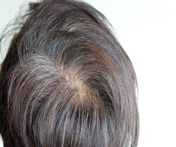Cancer Immune Drugs Darkened Patients' Gray Hair