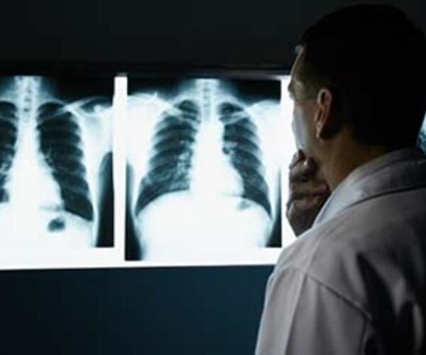 doctor evaluating images of lungs on big screen