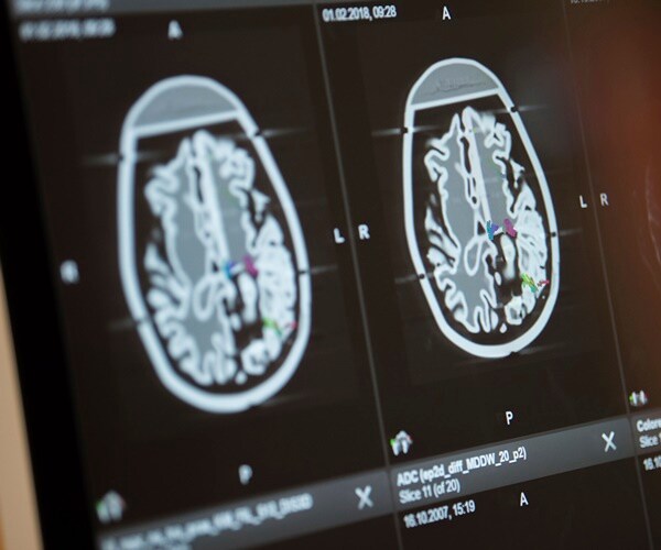 Kroger Recalls Frozen Berries That Might Have Hepatitis A