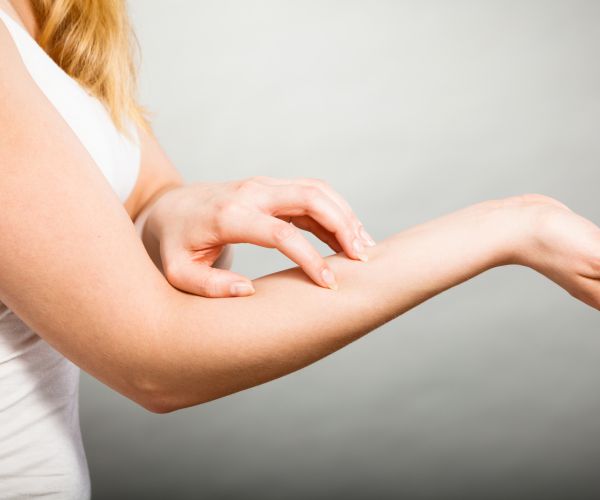 Gut, Diet Often Important to Diagnosing Skin Issues