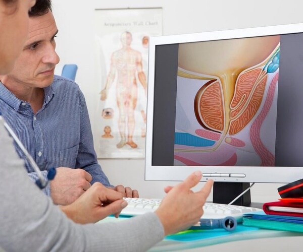 doctor discussing prostate cancer with patient