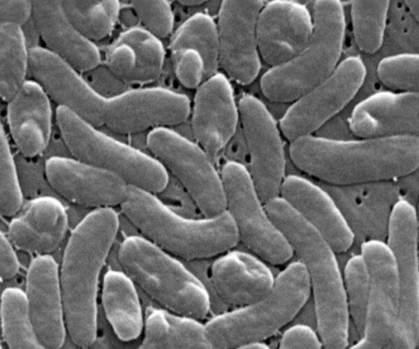 microscopic view of the Vibrio vulnificus