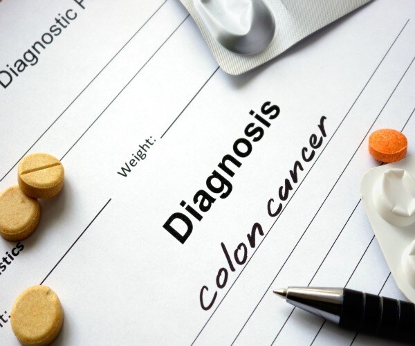 More Younger People Getting Colon Cancer 