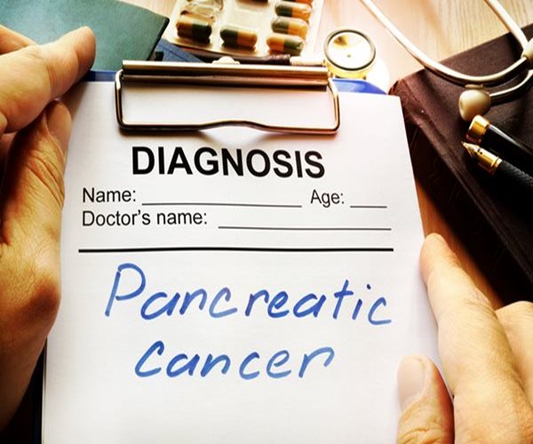 Four-Drug Combo Extends Pancreatic Cancer Survival