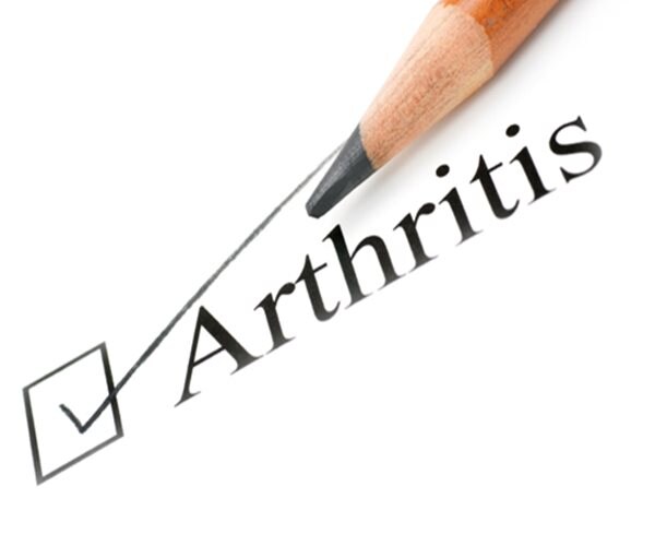Arthritis Rates Much Higher Than Current Estimates