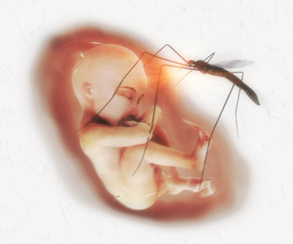 Birth Defects Occur in 6 Percent of US Zika Pregnancies