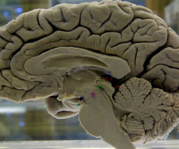 a model of the brain