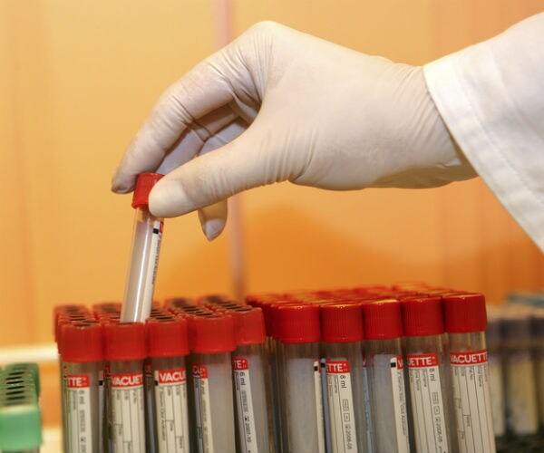 Blood Test Predicts Best Treatment for Advanced Prostate Cancer Patients