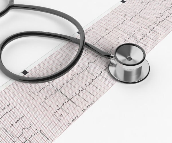 Can Too Much Exercise Harm Your Heart?