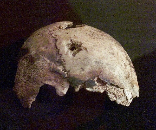 Hitler's Teeth Prove He Really Did Die at His Bunker