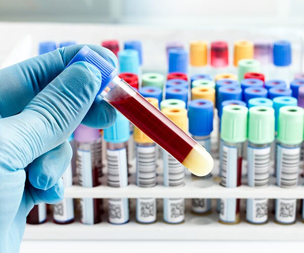 New Heart Attack Blood Test Faster at Confirming Diagnosis: Study