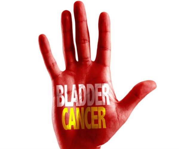 Invasive Bladder Cancer: No Longer a Death Sentence?