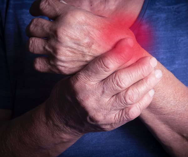 New Drug Approved to Fight Arthritis