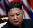 Japanese Official Thinks Kim Jong Un in Poor Health