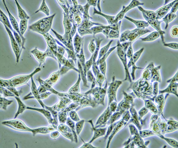 Prostate Cancer Laser Therapy Shows Promise Without Worst Side Effects