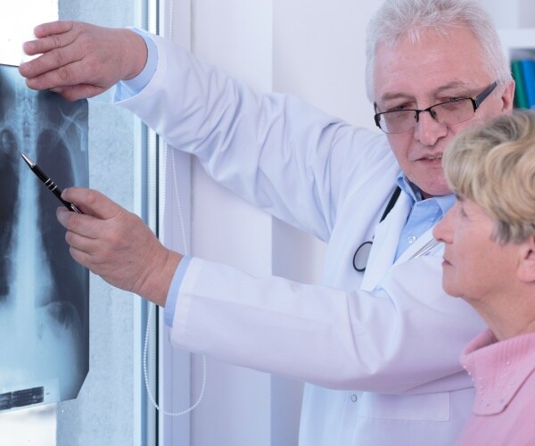 doctor showing an older woman an x-ray of her lung cancer
