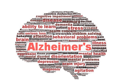 New Method of Defining Alzheimer's Hopes to Diagnose Disease Sooner