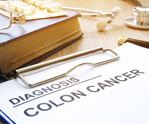 colon cancer diagnosis