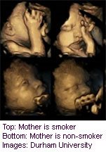 Fetal Faces React to Mom's Smoking