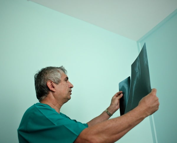 Spine Surgery May Not be Needed to Ease Back Pain from Osteoporosis