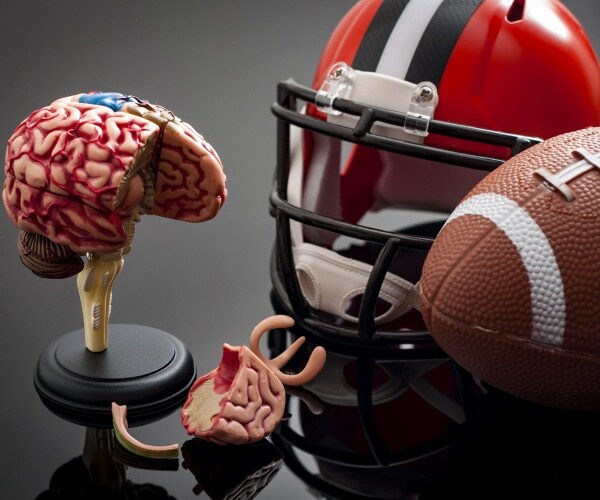 model of brain with damage, football helmet, football