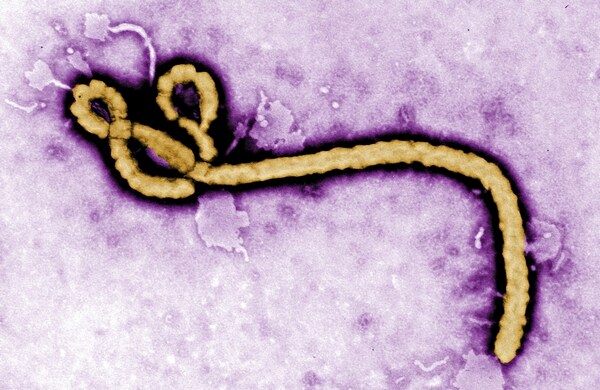 Ebola Symptoms: What to Watch For and How the Virus Spreads