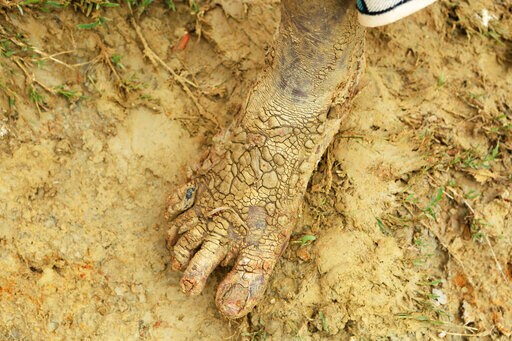 'Incredibly Difficult' to Reach Mozambique Cyclone Survivors