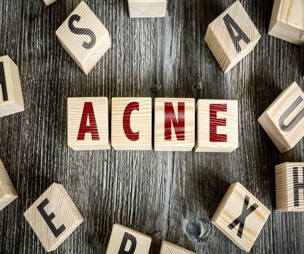 Acne May Protect Against Aging 