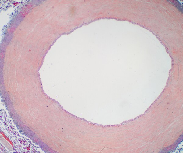 an artery under a microscope