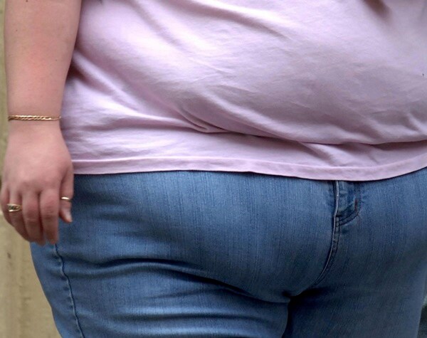 Obesity-Related Cancers Rising in US Young Adults