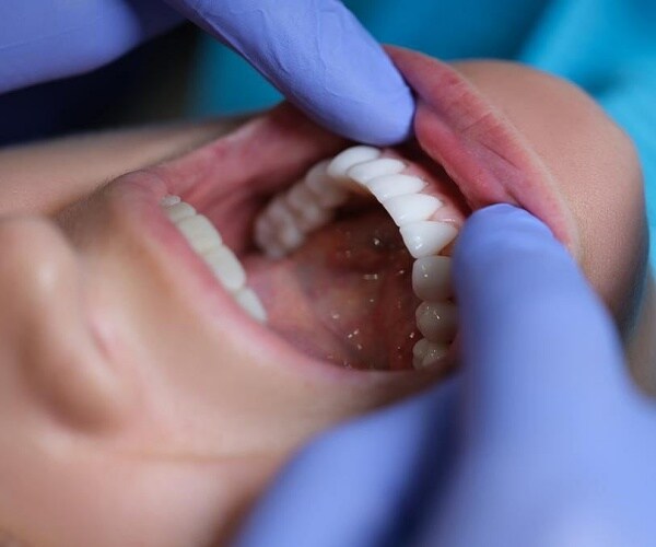 closeup of dentist examining patient's mouth
