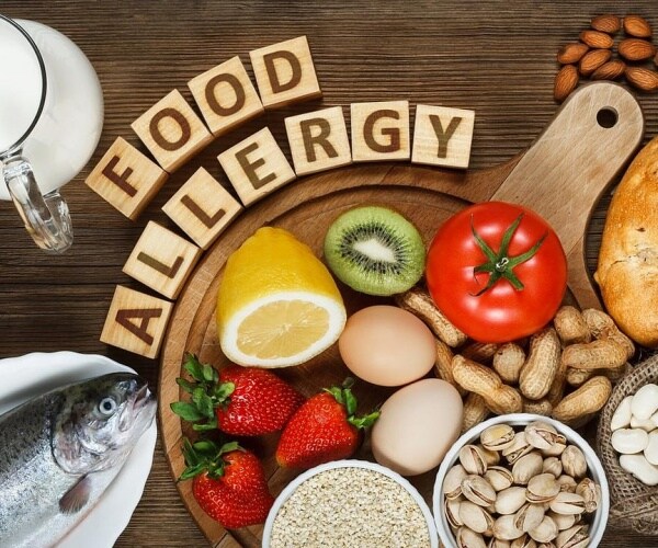 Food Allergy spelled out in blocks with foods that commonly cause allergies