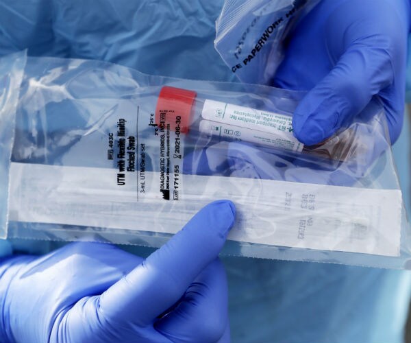 a swab test kit is shown