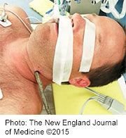 Mountain Biker Survives After Neck Impaled by Tree Branch