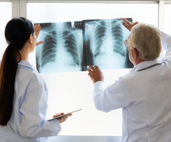 two radiologists looking at lung scans