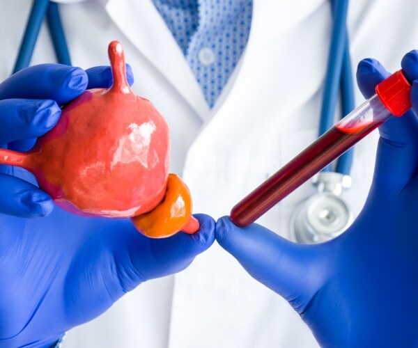 gloved hands holding a model of the prostate and a vial of blood for screening for prostate cancer