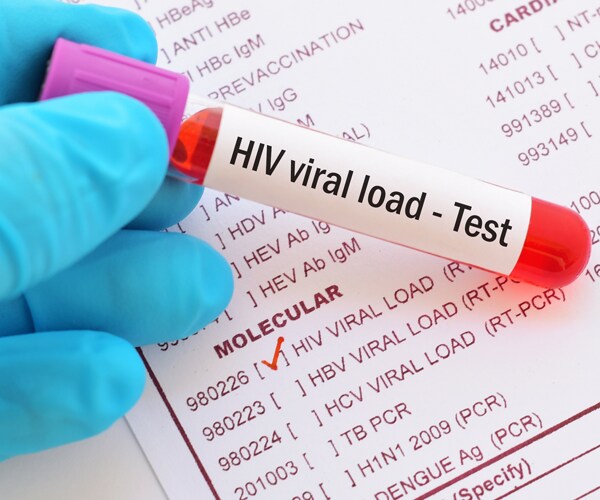 an hiv test