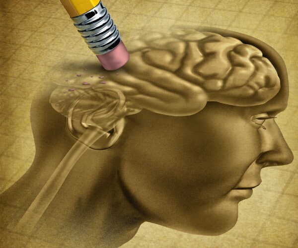 Curcumin: Can Asian Curry Spice Prevent Alzheimer's?