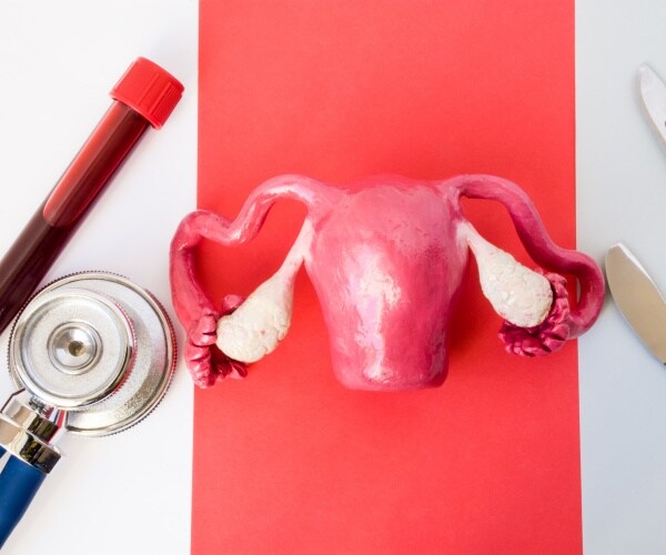 model of ovaries, etc. and a vial of blood