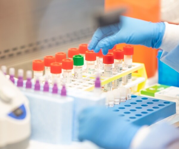 House Report Skewers FDA Over Alzheimer's Drug Approval